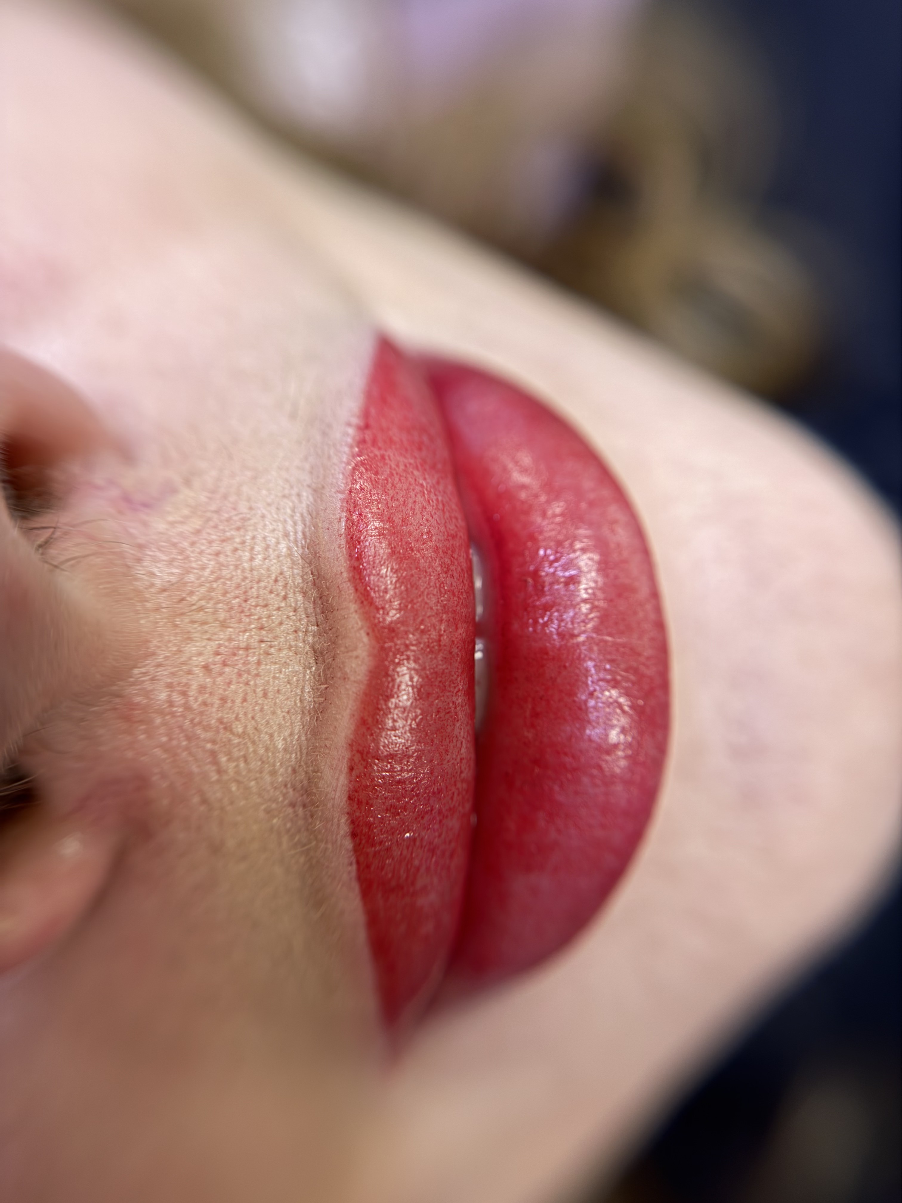 Detail výraznějšího výsledku LipBlush